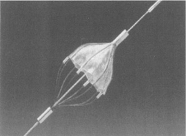 Рентгенэндоваскулярное лечение стенозов сонных артерий в Красноярске